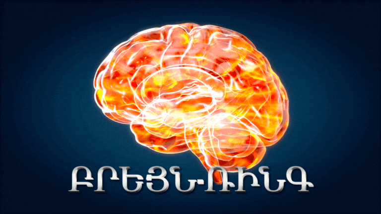 Բրեյն Ռինգ